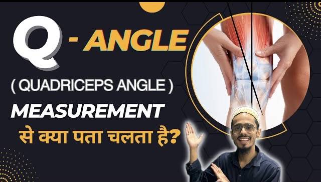 What is Q angle