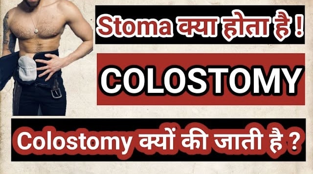 What is Colostomy ?