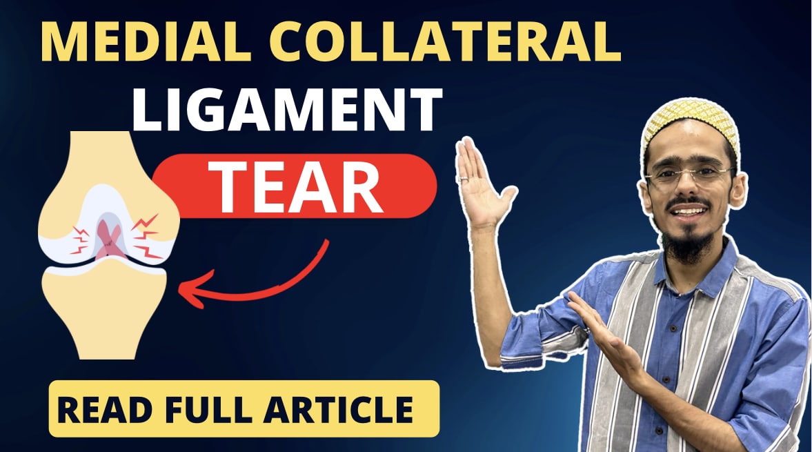 Medial collateral ligament tear