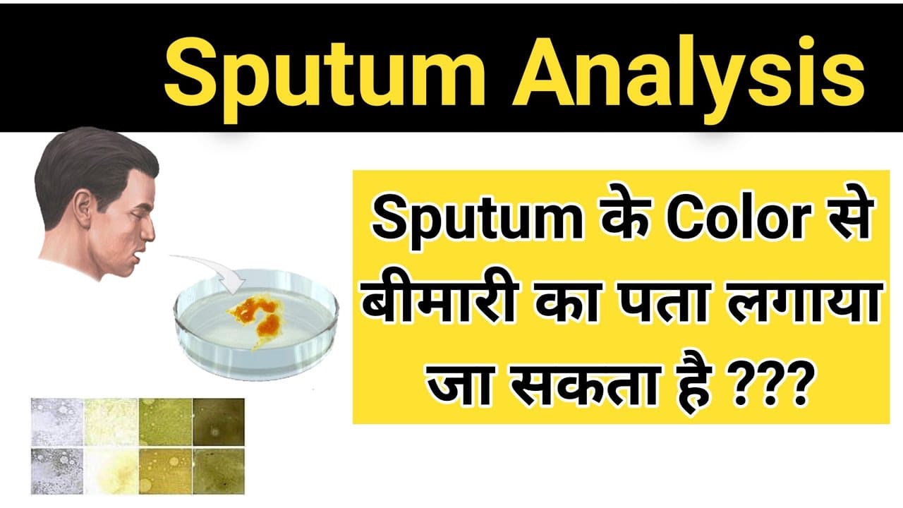 What is Sputum Test ?