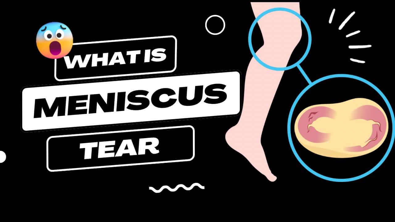 What is meniscus tear ?