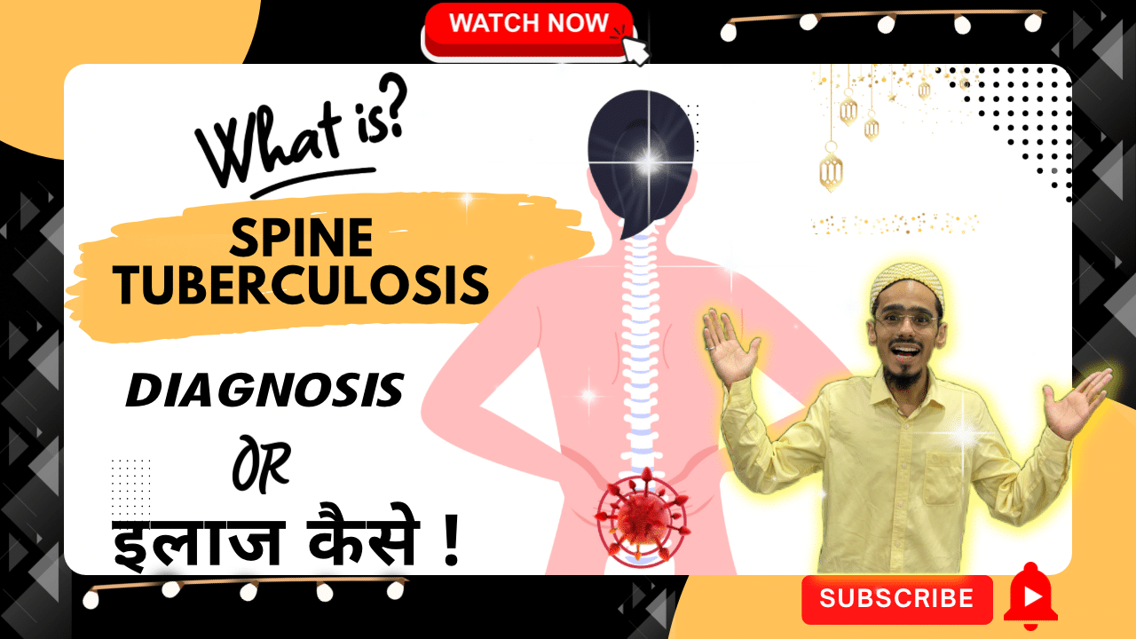 what is Spine Tuberculosis ?