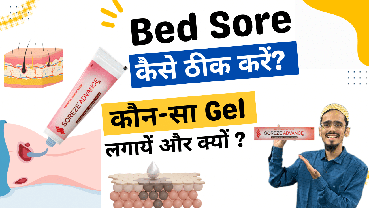 How to Treat Bed Sores at Home ? Physio talk official