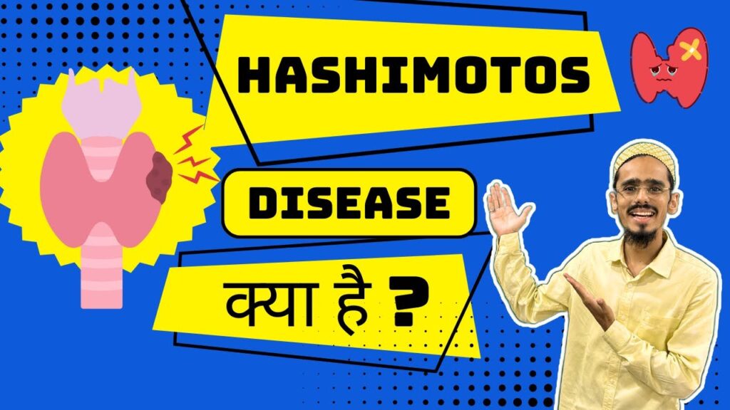 what-is-hashimoto-s-disease-physio-talk-official