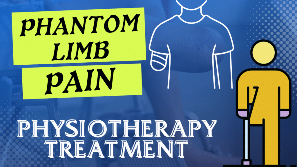 Phantom Rib Pain Understanding Phantom Limb Pain - Physio talk official