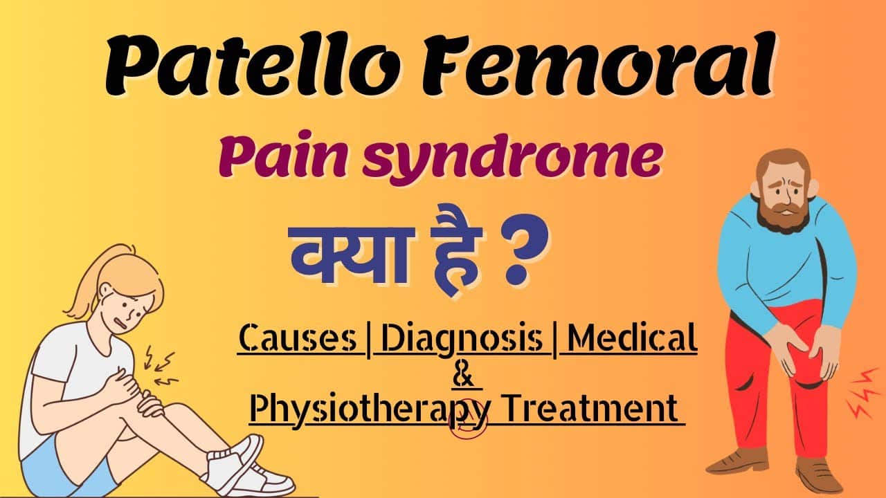 patello femoral pain syndrome