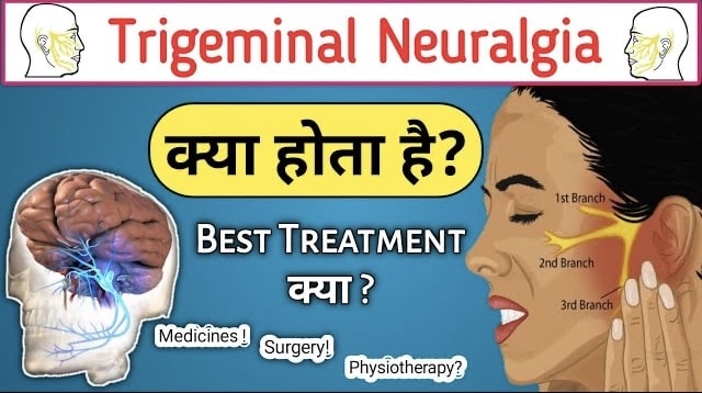 Trigeminal neuralgia