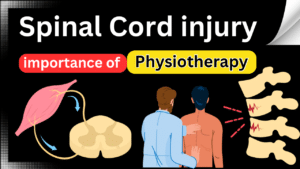 Spinal Cord Injury Rehabilitation The Pivotal Role of Physiotherapy