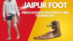 The Jaipur Foot Innovation in Prosthetic Limb Technology