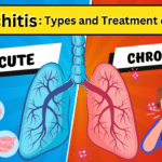 Bronchitis: The Condition, Its Types and Treatment