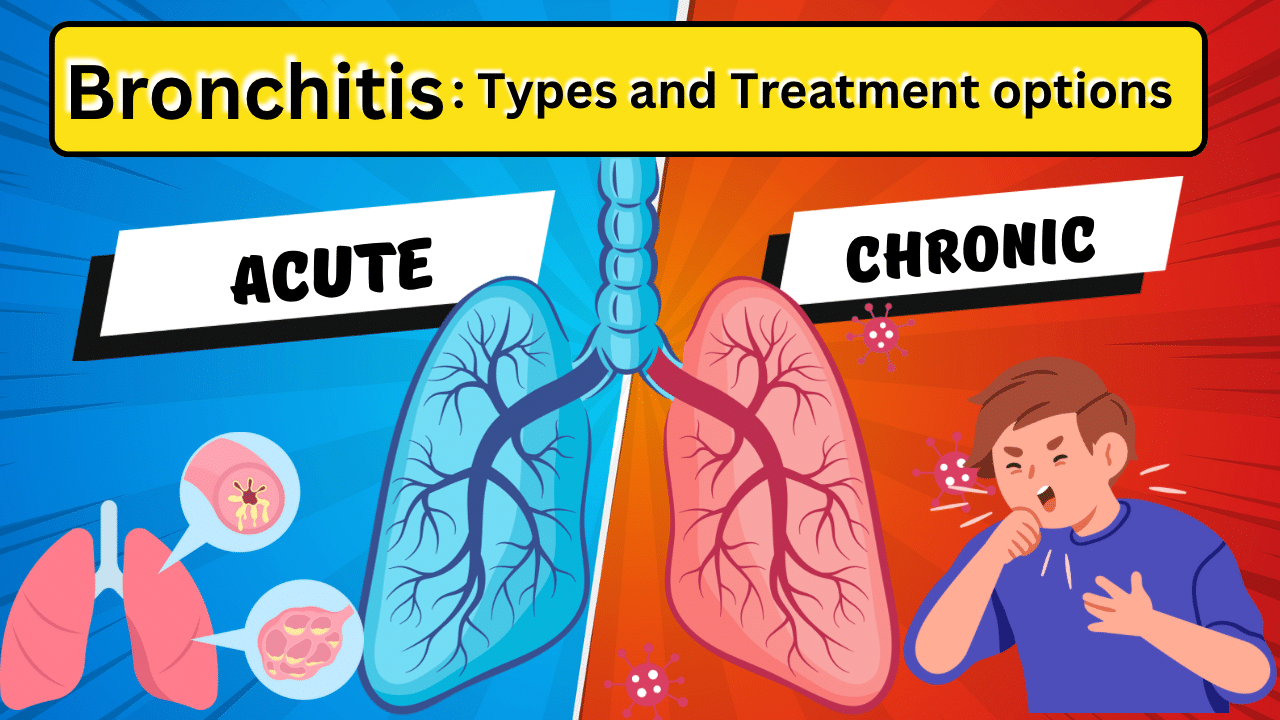 Bronchitis: The Condition, Its Types and Treatment