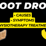 Foot Drop Causes Symptoms and Physiotherapy Treatments
