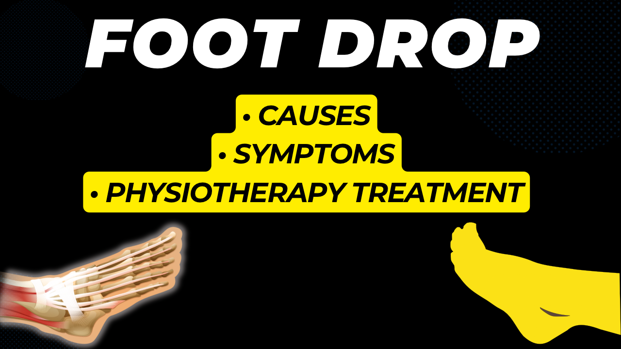 Foot Drop Causes Symptoms and Physiotherapy Treatments