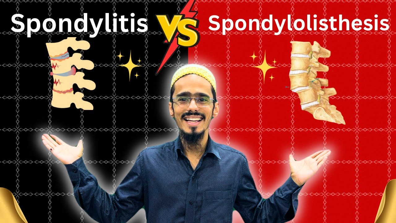 Spondylitis vs Spondylolisthesis: what is the difference