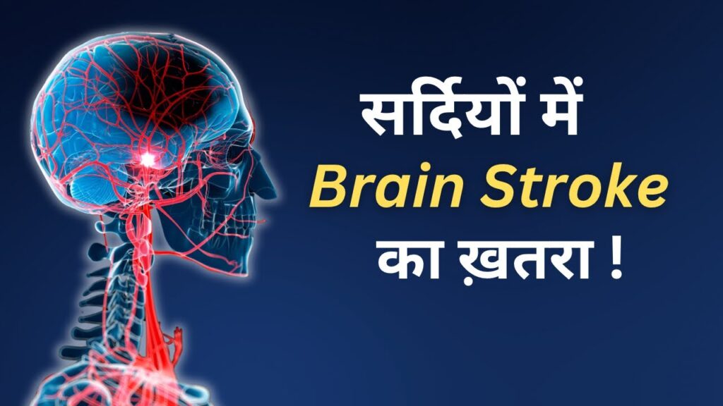 ठंड में Brain stroke का ख़तरा !