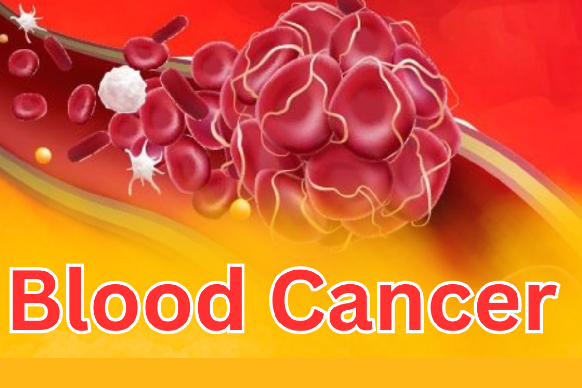 Early Signs of Blood Cancer