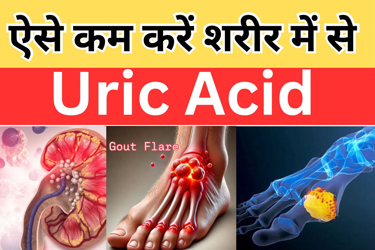 यूरिक एसिड बढ़ने से क्या होता है?