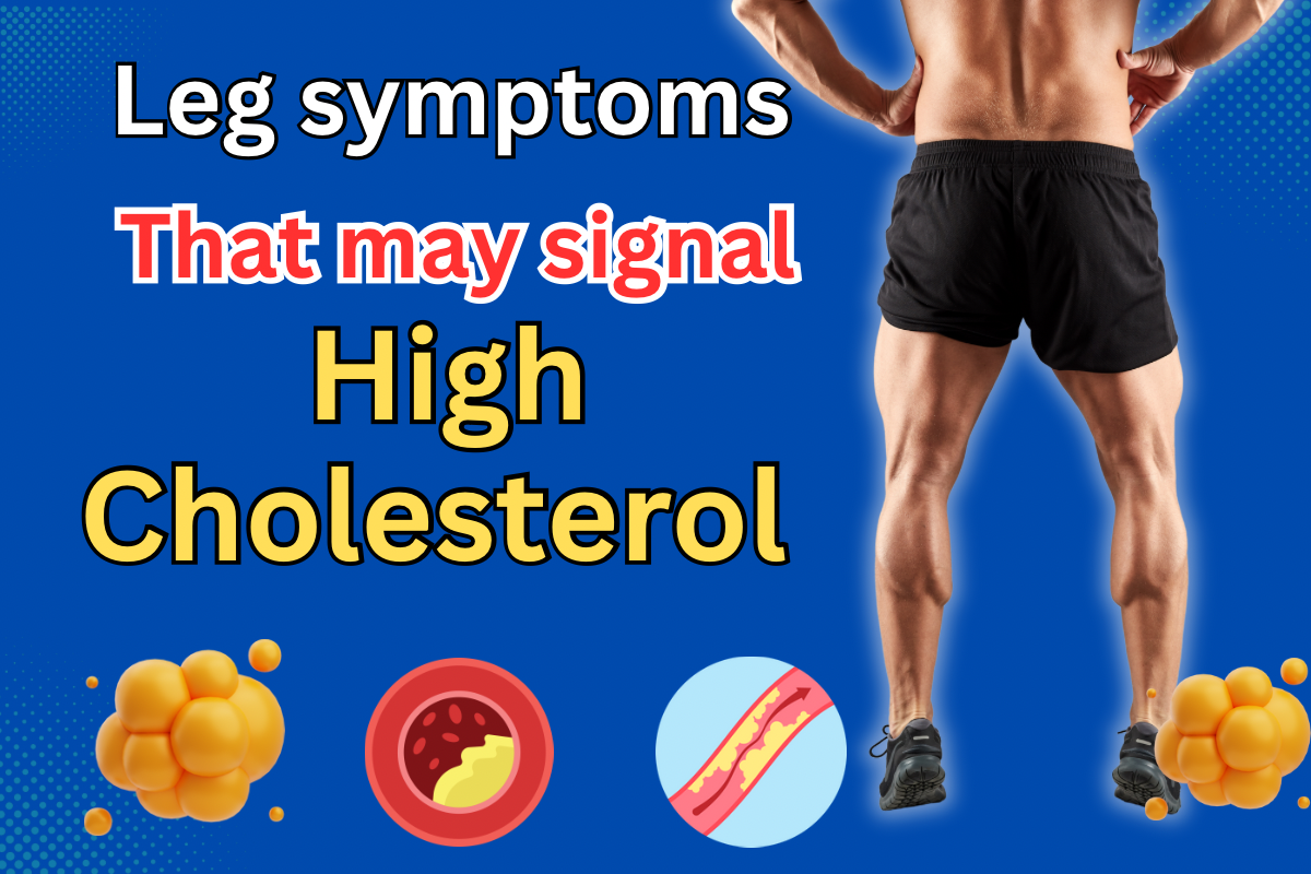 What is peripheral artery disease (PAD), and how is it related to high cholesterol?