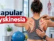Physiotherapist assessing scapular dyskinesia during a shoulder examination.
